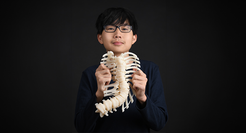Kai Weir holding a model of his spine